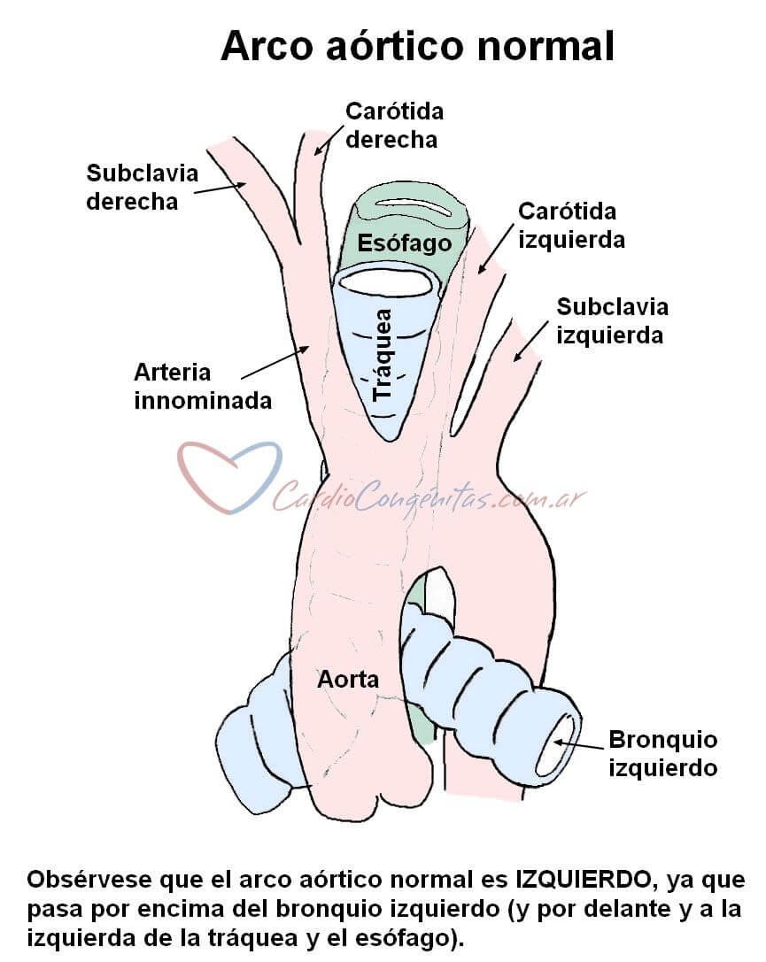 arco-aortico-normal