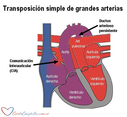 TGA-simple