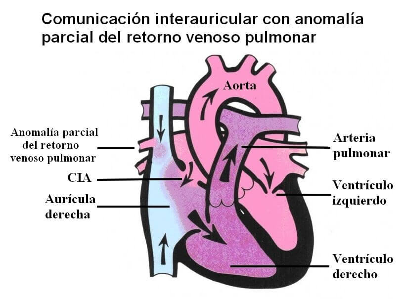 CIA-con-APRVP-fisiologia
