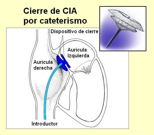 hemodinamia_clip_image003