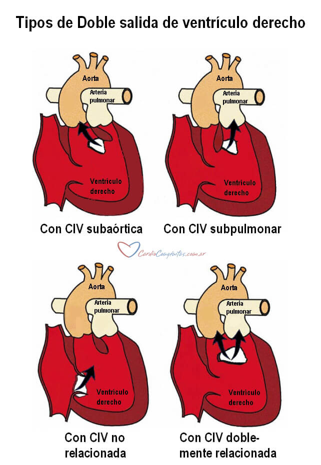 Tipos-de-DSVD