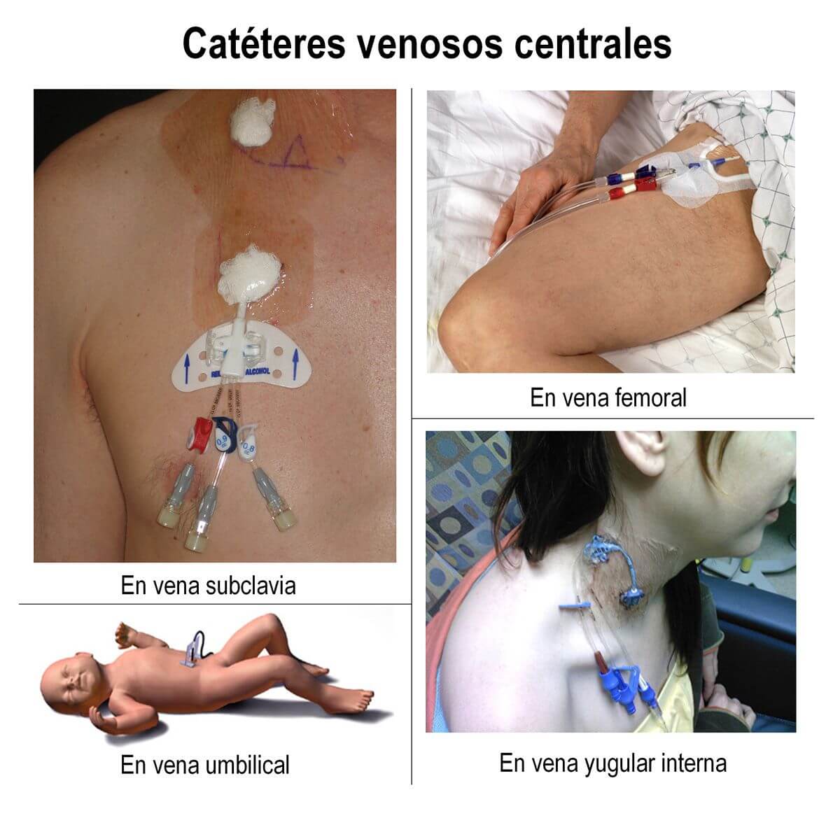 Vias-centrales