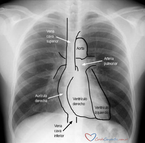Rx-torax-normal-con-corazon