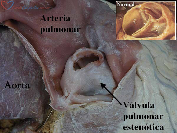 EP-anatomia-foto