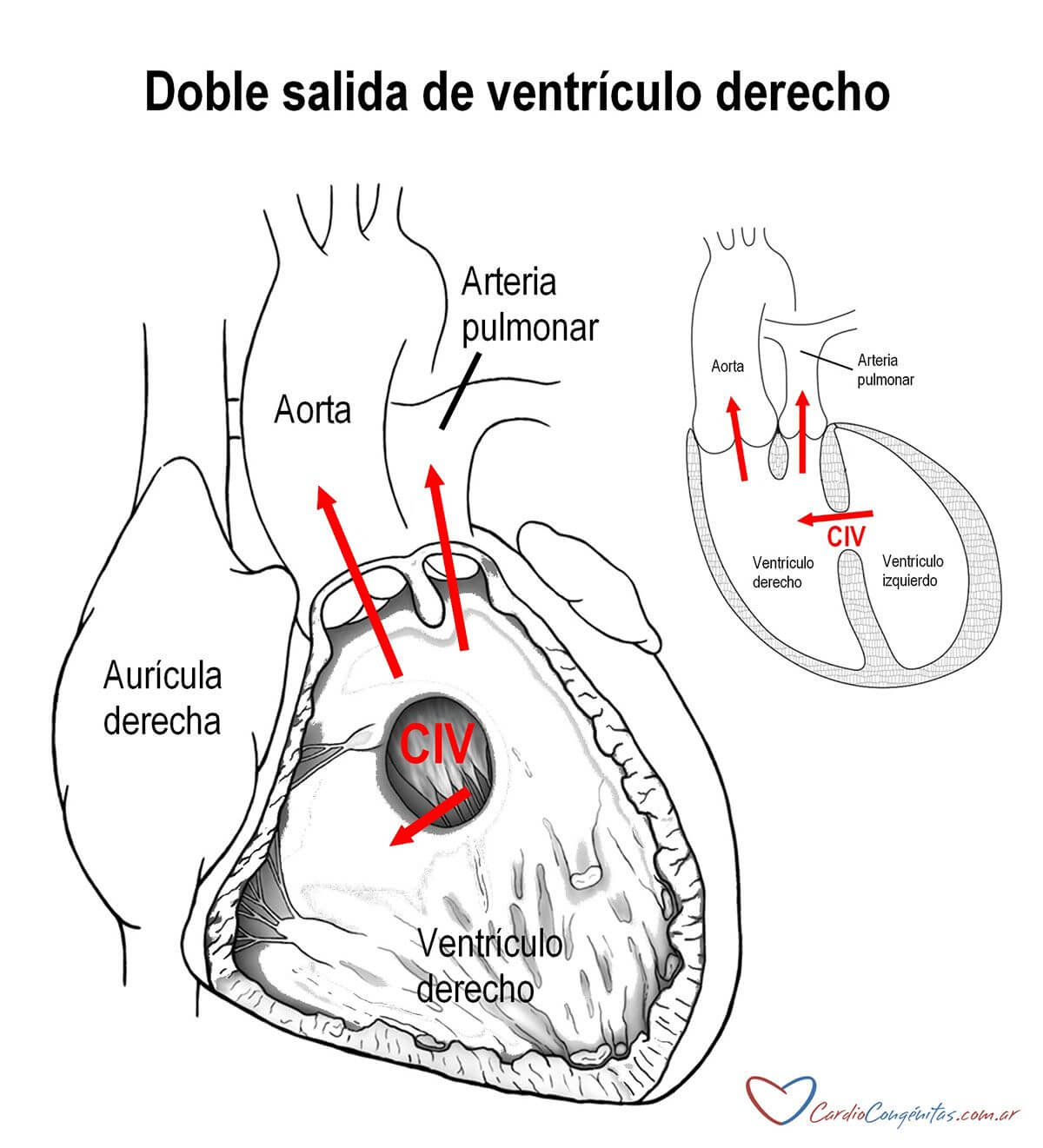 DSVD-anatomia