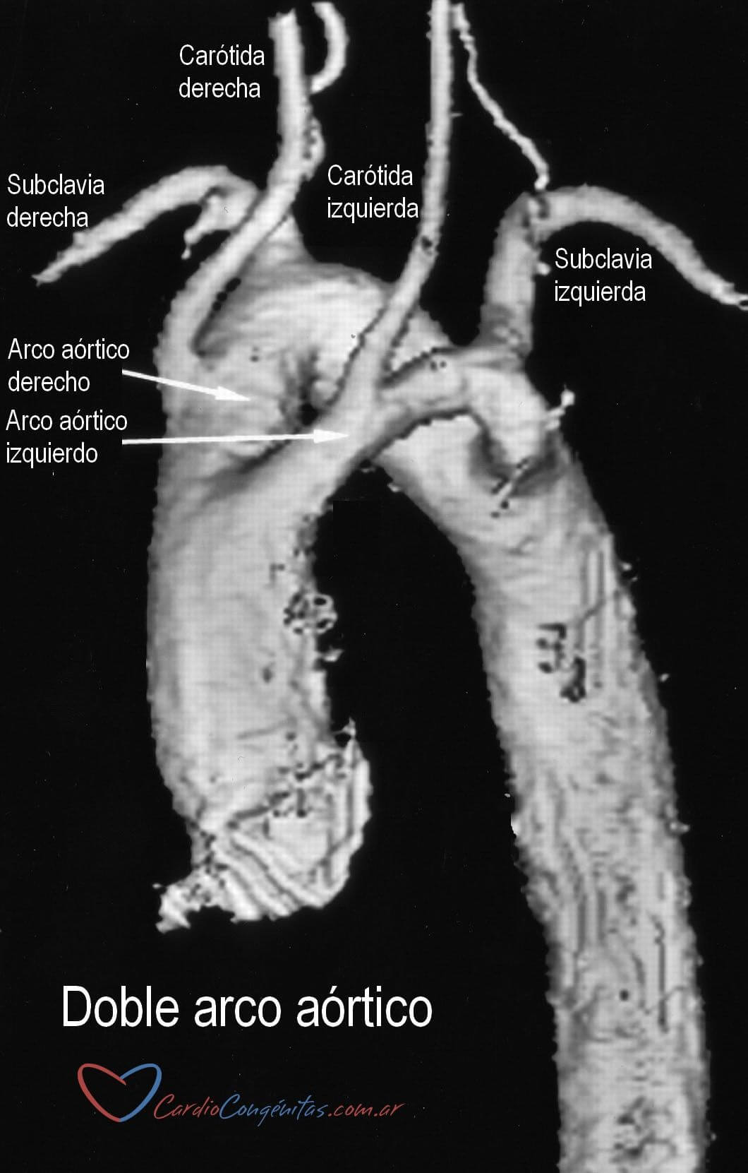 RMN-doble-arco