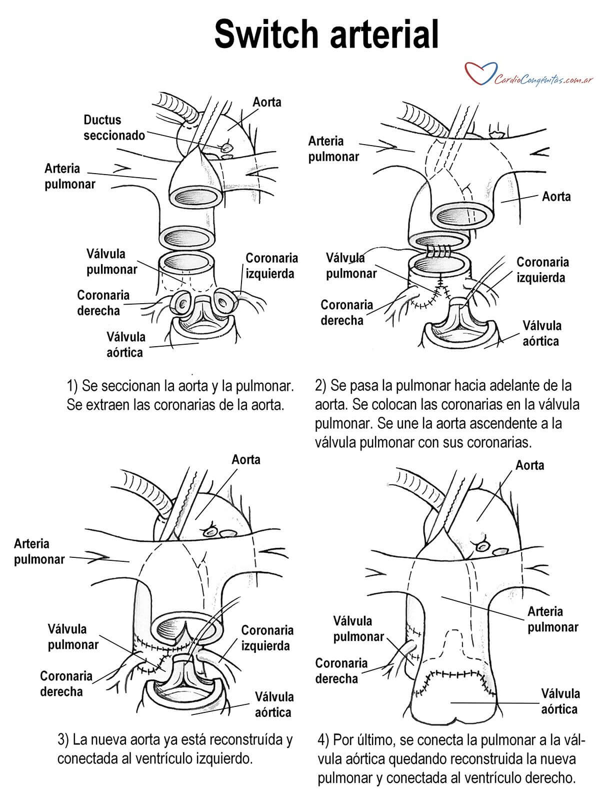 Switch-arterial