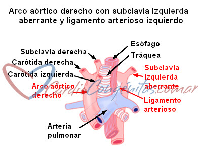arco-ao-der-subcl-izq-aberr-anatomia