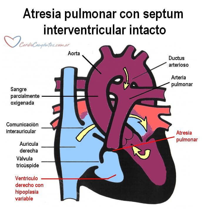 AP-con-SIV-intacto-anatomia
