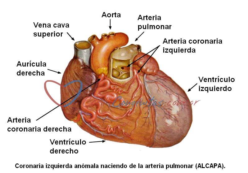 ALCAPA