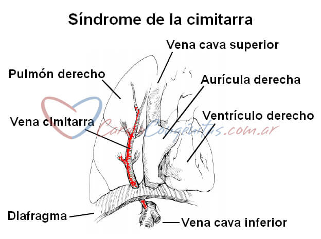 Cimitarra-esquema-listo