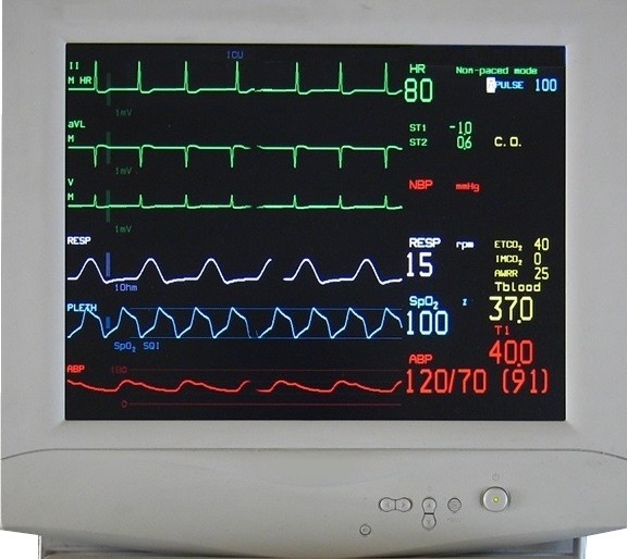 Monitor