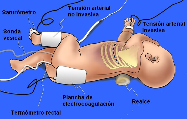 Posicion-del-pcte