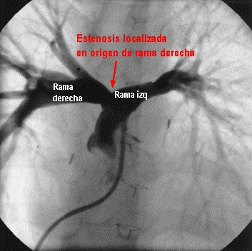 Est-localizada